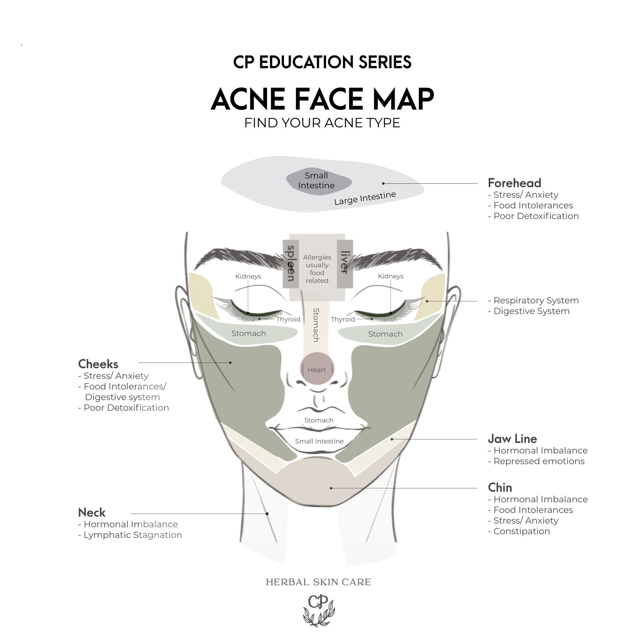 What does the area where you develop acne indicate about the factor ...